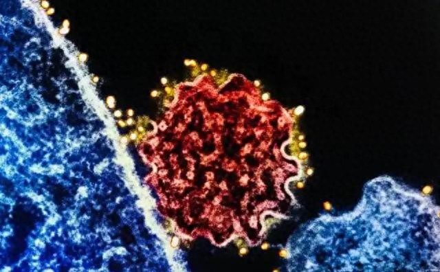 印度突发怪病，类似疫情爆发，致死快能隐藏，多国紧张