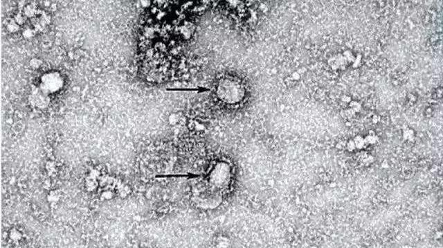 新冠疫情下中国举措受关注,各地医护人员驰援湖北